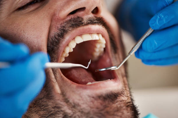 Best Dental Fillings (Composite and Amalgam)  in Buckeystown, MD